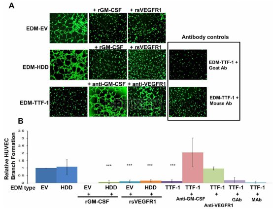 血管生成--甲狀腺轉(zhuǎn)錄因子-1（TTG-1）影響肺癌細胞血管生成