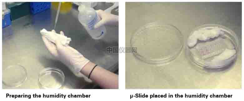 血管生成--甲狀腺轉(zhuǎn)錄因子-1（TTG-1）影響肺癌細胞血管生成