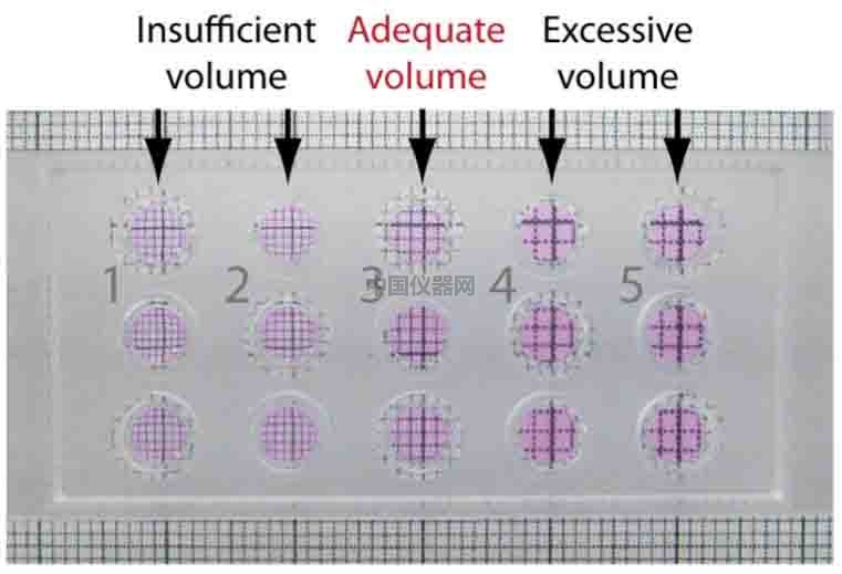 血管生成--甲狀腺轉(zhuǎn)錄因子-1（TTG-1）影響肺癌細胞血管生成